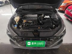 Hyundai Elantra 240TGDi DCT LUX Luxury Edition - ფოტო 19