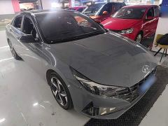 Hyundai Elantra 240TGDi DCT LUX Luxury Edition - ფოტო 3