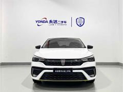 SAIC MG i5 1.5L CVT Platinum Edition - ფოტო 2
