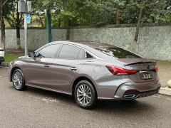 SAIC MG5 180DVVT Global Luxury Edition - ფოტო 2