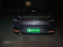 Hyundai Elantra 1.5L CVT 20th Anniversary Edition - фото 3