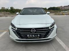 Nissan Teana 2.0L XL-TLS Enjoy Edition - фото 2