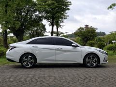 Hyundai Elantra 1.4T Edition - ფოტო 5
