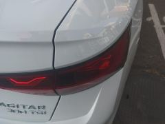 Volkswagen Jetta 300TSI Edition - ფოტო 5