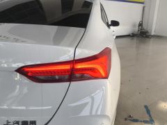Buick Verano Pro 1.5T Joy Edition - ფოტო 5