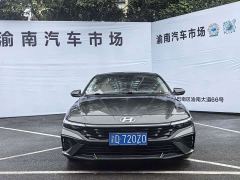Hyundai Elantra 1.5L CVT Luxury - ფოტო 2