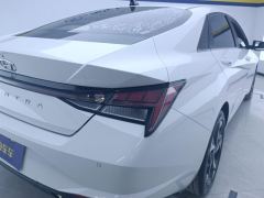 Hyundai Elantra 1.5L CVT Elite Edition - ფოტო 5